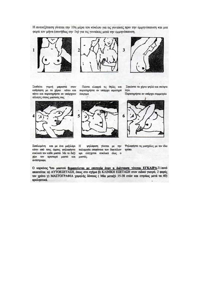 ΑΥΤΟΕΞΕΤΑΣΗ ΜΑΣΤΟΥ